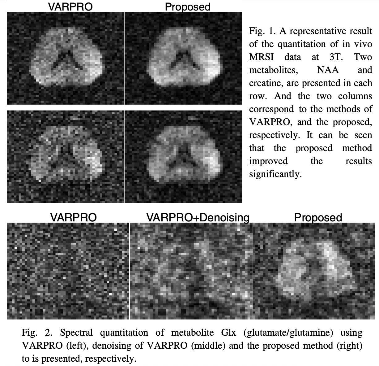 ismrm15-preview.png